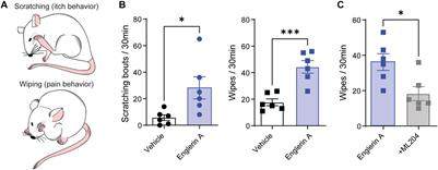 Transient Receptor Potential Channel 4 Small-Molecule Inhibition Alleviates Migraine-Like Behavior in Mice